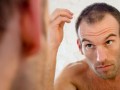 preventing-hairloss